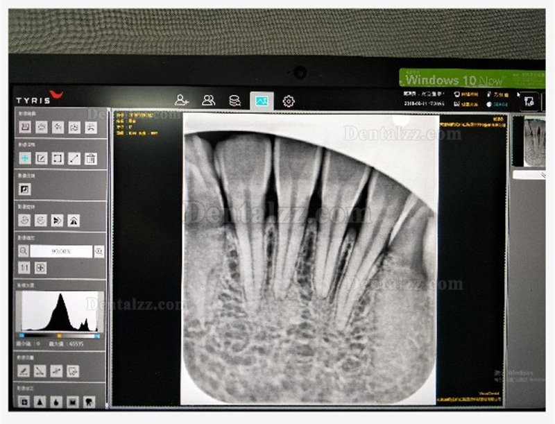 TYRIS TR-100 歯科用口腔内CRイメージングプレートスキャナー PSPX線スキャナー